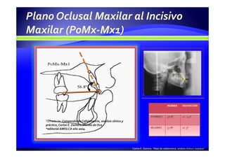 Carlos E. Zamora. “Atlas de cefalometría, análisis clínico y practico”
Tomado de: Compendio de Cefalometría, análisis clínico y
práctico, Carlos E. Zamora Montes de Oca
*editorial AMOLCA año 2004
 