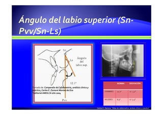 Carlos E. Zamora. “Atlas de cefalometría, análisis clínico y practico”
Tomado de: Compendio de Cefalometría, análisis clínico y
práctico, Carlos E. Zamora Montes de Oca
*editorial AMOLCA año 2004
 