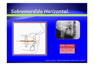 Carlos E. Zamora. “Atlas de cefalometría, análisis clínico y practico”
 
