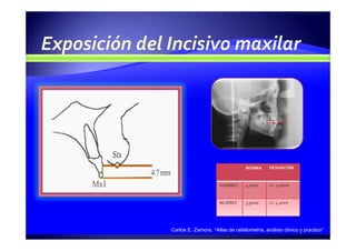Carlos E. Zamora. “Atlas de cefalometría, análisis clínico y practico”
 