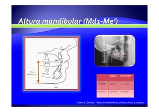 Carlos E. Zamora. “Atlas de cefalometría, análisis clínico y practico”
 