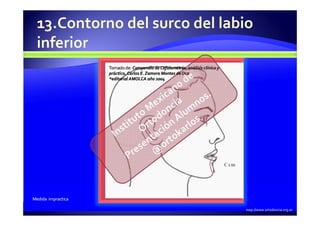 Carlos E. Zamora. “Atlas de cefalometría, análisis clínico y practico”
Tomado de: Compendio de Cefalometría, análisis clín...