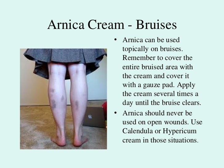 Arnica montana - Bruises, Trauma, Sprains, Falls