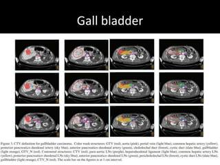 Gall bladder
184
 