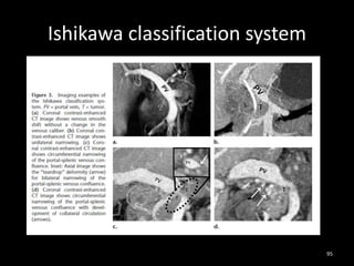 Ishikawa classification system
95
 