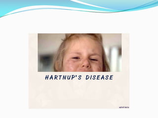 Aromatic amino acids 