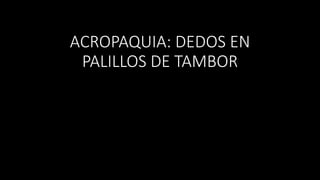 ACROPAQUIA: DEDOS EN
PALILLOS DE TAMBOR
 