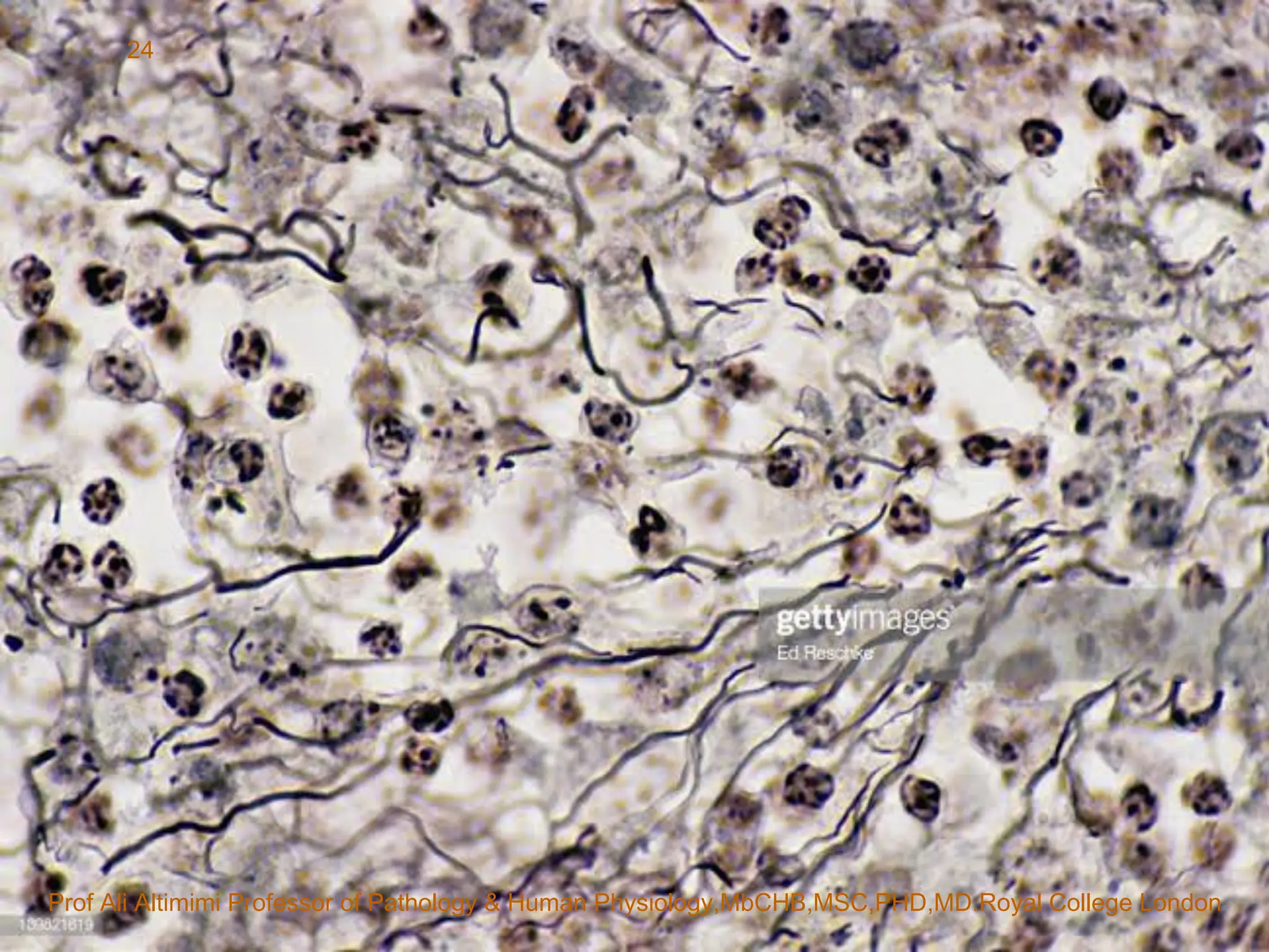 Routine Staining A Routine and Special Staining in Histopathology LAB practice lec ...