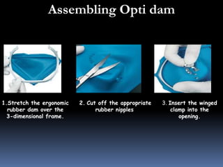 FOR POSTERIOR TEETH 
1. Position the clamp 
with OptiDam 
Posterior in one step. 
2. Place the rubber dam 
behind the wing...