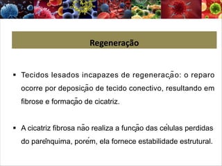 § Tecidos lesados incapazes de regeneração: o reparo
ocorre por deposição de tecido conectivo, resultando em
fibrose e formação de cicatriz.
§ A cicatriz fibrosa não realiza a função das células perdidas
do parênquima, porém, ela fornece estabilidade estrutural.
Regeneração
 