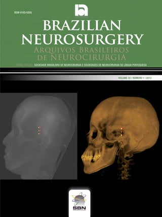 ISSN 0103-5355

brazilian
neurosurgery
Arquivos Brasileiros
de NEUROCIRURGIA

Órgão oficial: sociedade Brasileira de Neurocirurgia e sociedades de Neurocirurgia de Língua portuguesa

Volume 32 | Número 1 | 2013

 