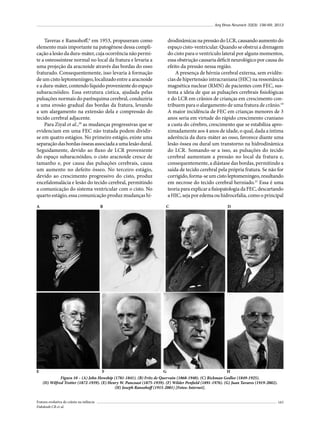 Arq Bras Neurocir 32(3): 156-69, 2013

Taveras e Ransohoff,6 em 1953, propuseram como
elemento mais importante na patogênese dessa complicação a lesão da dura-máter, cuja ocorrência não permite a osteossíntese normal no local da fratura e levaria a
uma projeção da aracnoide através das bordas do osso
fraturado. Consequentemente, isso levaria à formação
de um cisto leptomeníngeo, localizado entre a aracnoide
e a dura-máter, contendo líquido proveniente do espaço
subaracnóideo. Essa estrutura cística, ajudada pelas
pulsações normais do parênquima cerebral, conduziria
a uma erosão gradual das bordas da fratura, levando
a um alargamento na extensão dela e compressão do
tecido cerebral adjacente.
Para Ziyal et al.,20 as mudanças progressivas que se
evidenciam em uma FEC não tratada podem dividirse em quatro estágios. No primeiro estágio, existe uma
separação das bordas ósseas associada a uma lesão dural.
Seguidamente, devido ao fluxo de LCR proveniente
do espaço subaracnóideo, o cisto aracnoide cresce de
tamanho e, por causa das pulsações cerebrais, causa
um aumento no defeito ósseo. No terceiro estágio,
devido ao crescimento progressivo do cisto, produz
encefalomalácia e lesão do tecido cerebral, permitindo
a comunicação do sistema ventricular com o cisto. No
quarto estágio, essa comunicação produz mudanças hiA

E

B

drodinâmicas na pressão do LCR, causando aumento do
espaço cisto-ventricular. Quando se obstrui a drenagem
do cisto para o ventrículo lateral por alguns momentos,
essa obstrução causaria déficit neurológico por causa do
efeito da pressão nessa região.
A presença de hérnia cerebral externa, sem evidências de hipertensão intracraniana (HIC) na ressonância
magnética nuclear (RMN) de pacientes com FEC, sustenta a ideia de que as pulsações cerebrais fisiológicas
e do LCR em crânios de crianças em crescimento contribuem para o alargamento de uma fratura de crânio.19
A maior incidência de FEC em crianças menores de 3
anos seria em virtude do rápido crescimento craniano
a custa do cérebro, crescimento que se estabiliza aproximadamente aos 4 anos de idade, o qual, dada a íntima
aderência da dura-máter ao osso, favorece diante uma
lesão óssea ou dural um transtorno na hidrodinâmica
do LCR. Somando-se a isso, as pulsações do tecido
cerebral aumentam a pressão no local da fratura e,
consequentemente, a diástase das bordas, permitindo a
saída de tecido cerebral pela própria fratura. Se não for
corrigido, forma-se um cisto leptomeníngeo, resultando
em necrose do tecido cerebral herniado.21 Essa é uma
teoria para explicar a fisiopatologia da FEC, descartando
a HIC, seja por edema ou hidrocefalia, como o principal
C

D

F
G
H
Figura 10 – (A) John Howship (1781-1841). (B) Fritz de Quervain (1868-1940). (C) Rickman Godlee (1849-1925).
(D) Wilfred Trotter (1872-1939). (E) Henry W. Pancoast (1875-1939). (F) Wilder Penfield (1891-1976). (G) Juan Tavares (1919-2002).
(H) Joseph Ransohoff (1915-2001) [Fotos: Internet].

Fratura evolutiva de crânio na infância
Dabdoub CB et al.

163

 