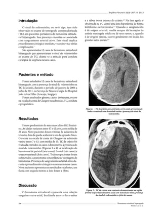 Arq Bras Neurocir 32(3): 207-10, 2013

Introdução
O sinal do redemoinho, ou swirl sign, tem sido
observado no exame de tomografia computadorizada
(TC), em pacientes portadores de hematoma extradural hiperagudo. Sua presença encontra-se associada
com sangramento arterial ativo. Esse sinal implica
procedimento cirúrgico imediato, visando evitar sérias
complicações.1
São apresentados 12 casos de hematoma extradural
hiperagudo que apresentaram o sinal do redemoinho
ao exame de TC; chama-se a atenção para conduta
cirúrgica de urgência nesses casos.

e a tábua óssea interna do crânio.2,3 Na fase aguda é
observada na TC como uma área hiperdensa de forma
lentiforme ou biconvexa.1,2 Quando o sangramento
é de origem arterial, resulta sempre da laceração da
artéria meningeia média ou de seus ramos, e, quando
é de origem venosa, ocorre geralmente em locais dos
grandes seios durais.3,4

Pacientes e método
Foram estudados 12 casos de hematoma extradural
hiperagudo, com a presença do sinal do redemoinho na
TC do crânio, durante o período de janeiro de 2006 a
julho de 2011, no Serviço de Neurocirurgia do Hospital
João Alves Filho (Aracaju, Sergipe).
Foram analisados gênero, causas do trauma, escore
na escala de coma de Glasgow na admissão, TC, conduta
e prognóstico.
Figura 1 – TC de crânio sem contraste, corte axial apresentando
lesão extradural com densidade mista e presença do sinal do
redemoinho.

Resultados
Houve predomínio do sexo masculino 10:2 feminino. As idades variaram entre 17 e 42 anos, com média de
26 anos. Nove pacientes foram vítimas de acidentes de
trânsito, dois de queda acidental e um de agressão física.
O escore na escala de coma de Glasgow na admissão
variou entre 7 e 13, com média de 10. TC de crânio foi
realizada em todos os casos e demonstrou a presença do
sinal do redemoinho (Figuras 1 a 4). A localização do
hematoma foi parietal (sete casos), frontal (três casos) e
temporoparietal (dois casos). Todos os pacientes foram
submetidos a craniotomia osteoplástica e drenagem do
hematoma. Presença de sangramento arterial ativo durante o procedimento cirúrgico ocorreu em nove casos.
Nove pacientes apresentaram resultados excelentes, um
ficou com sequela motora e dois foram a óbito.

Discussão
O hematoma extradural representa uma coleção
sanguínea extra-axial, localizada entre a dura-máter
208

Figura 2 – TC de crânio sem contraste demonstrando na região
frontal esquerda lesão extra-axial com densidade mista, presença
do sinal do redemoinho e efeito de massa.

Hematoma extradural hiperagudo
Pereira CU et al.

 