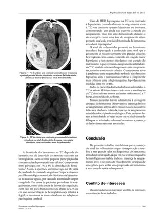 Arq Bras Neurocir 32(3): 207-10, 2013

Figura 3 – TC de crânio sem contraste com volumoso hematoma
epidural parietal direito, desvio das estruturas da linha média,
densidade mista e presença do sinal do redemoinho.

Figura 4 – TC de crânio sem contraste apresentando hematoma
extradural parietal direito, efeito de massa e com dupla
densidade, caracterizando o sinal do redemoinho.

A densidade do hematoma na TC depende do
hematócrito, do conteúdo de proteína existente na
hemoglobina, além de uma pequena participação das
concentrações de protoporfirina e cálcio. O componente
ferro participa com 7% a 8% da densidade do hematoma.5 Assim, a aparência da hemorragia na TC varia
dependendo do conteúdo sanguíneo. Em pacientes com
perfil hematológico normal, ela é tipicamente hiperdensa na sua fase aguda, por causa do acúmulo de sangue
coagulado. Em casos de pacientes portadores de coagulopatias, como deficiência de fatores da coagulação,
e em caso em que o hematócrito seja abaixo de 23% ou
em que a concentração de hemoglobina seja inferior a
8 g/dl, o hematoma se mostra isodenso em relação ao
parênquima cerebral.
Hematoma extradural hiperagudo
Pereira CU et al.

Caso de HED hiperagudo na TC sem contraste
é hiperdenso, contudo durante o sangramento ativo
a TC sem contraste aparece hipodensa ou isodensa,
demonstrando que ainda não ocorreu a parada do
sangramento.1 Isso tem sido demonstrado durante o
ato cirúrgico, como uma área de sangramento ativo,
portanto essa lesão tem sido denominada de hematoma
extradural hiperagudo.6
O sinal do redemoinho presente em hematoma
extradural hiperagudo é conhecido com swirl sign e
geralmente se encontra presente em grandes coleções
heterogêneas extra-axiais, contendo um coágulo maior
hiperdenso e um menor hipodenso com aspecto de
redemoinho e que representa sangramento arterial ativo.1,3,7 O sinal do redemoinho apresenta dois componentes, um ativo e outro mais crônico. O componente ativo
é geralmente uma pequena lesão redonda e isodenso ou
hipodenso com o parênquima cerebral; o componente
mais crônico é uma coleção sanguínea hiperdensa com
medidas entre 50-70 HU.
Todos os pacientes deste estudo foram submetidos à
TC de crânio. O intervalo entre o trauma e a realização
de TC de crânio em nossos pacientes variou entre 2 e 7
horas, com média de 2,5 horas.
Nossos pacientes foram submetidos à drenagem
cirúrgica do hematoma. Observamos a presença de foco
de sangramento arterial ativo em nove casos; nos outros
três casos não havia relato da presença de sangramento
arterial na descrição do ato cirúrgico. Dois pacientes foram a óbito devido ao baixo escore na escala de coma de
Glasgow na admissão, volumoso hematoma e presença
de lesões intracranianas associadas.

Conclusão
Do presente trabalho, concluímos que a presença
do sinal do redemoinho requer interpretação cautelosa e tem grande valor no diagnóstico de hematoma
extradural hiperagudo, já que em pacientes com quadro
hematológico normal ela indica a presença de sangramento ativo e necessita de procedimento cirúrgico de
emergência para evitar uma progressão do hematoma
e suas complicações subsequentes.

Conflito de interesses
Os autores declaram não haver conflito de interesses
na realização deste trabalho.

209

 