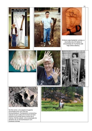 31
Embora seja bastante curiosa, a
anomalia dos 24 dedos é
encontrada em humanos até
hoje (fotos abaixo).
Na foto acima, uma pegada de gigante
encontrada junto com outra de
Acrocantossauro. Comparando os tamanhos,
calcula-se que a altura do humano era bem
próxima a do animal (pouco acima dos 4
metros). Na foto abaixo, uma comparação do
tamanho de um Acrocantossauro com
humanos normais
 