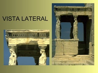 VISTA LATERAL 