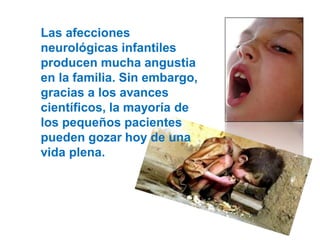 Las afecciones
neurológicas infantiles
producen mucha angustia
en la familia. Sin embargo,
gracias a los avances
científicos, la mayoría de
los pequeños pacientes
pueden gozar hoy de una
vida plena.
 