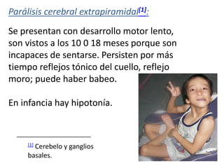 Parálisis cerebral extrapiramidal[1]:
Se presentan con desarrollo motor lento,
son vistos a los 10 0 18 meses porque son
incapaces de sentarse. Persisten por más
tiempo reflejos tónico del cuello, reflejo
moro; puede haber babeo.
En infancia hay hipotonía.
[1] Cerebelo y ganglios
basales.
 
