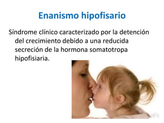 Enanismo hipofisario
Síndrome clínico caracterizado por la detención
del crecimiento debido a una reducida
secreción de la hormona somatotropa
hipofisiaria.
 