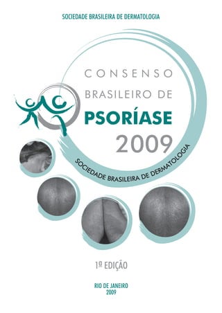 SOCIEDADE BRASILEIRA DE DERMATOLOGIA




                                                 IA
                                             G
                                           O
     O                                       L
                                           TO
   S




         CI                              A
           ED
             AD                      ER M
                  E BRASILEIRA   DE D




            1a EDIÇÃO

            RIO DE JANEIRO
                 2009
 