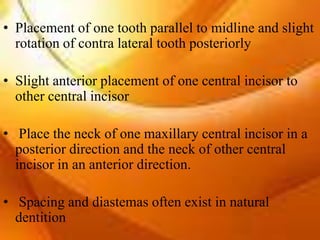 Arrangement of anterior artificial teeth | PPTX