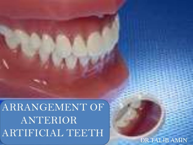 teeth setting
