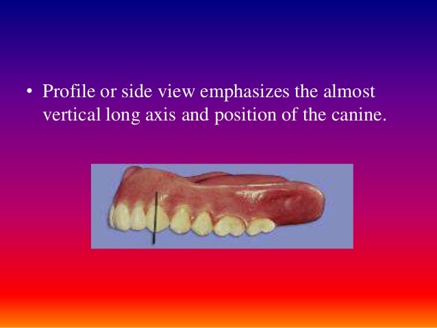 teeth setting