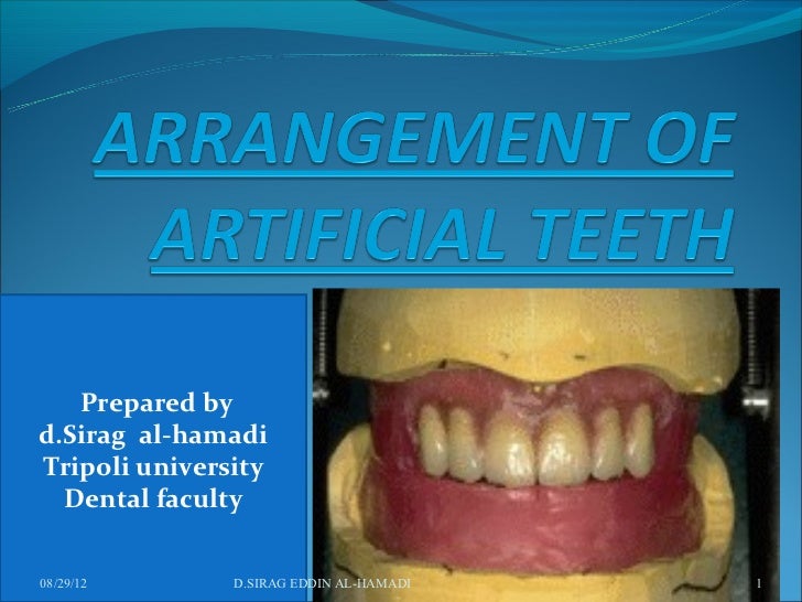 teeth setting