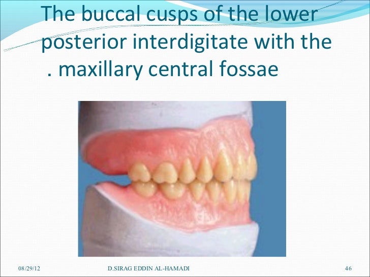 teeth setting