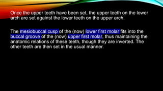 Arrangement of artificial teeth in abnormal jaw relations.pptx