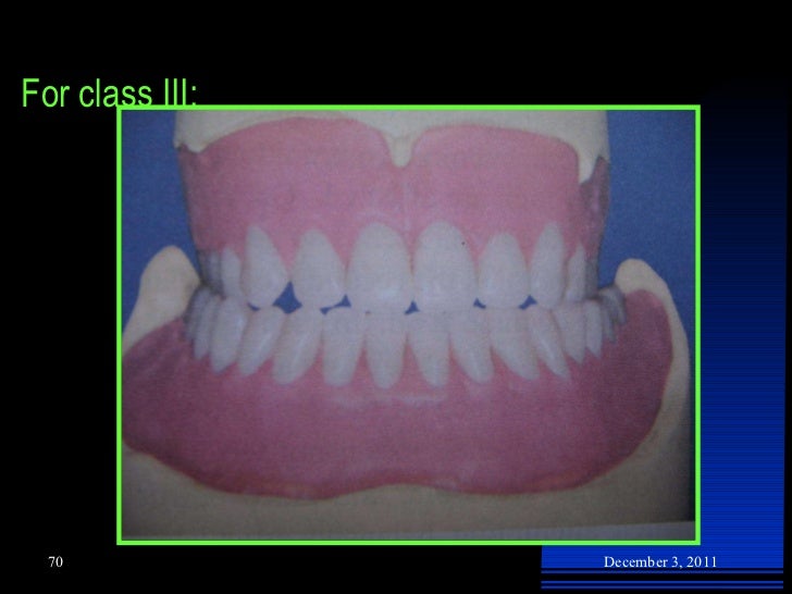 teeth setting