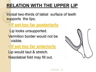 Arrangement of teeth in complete denture | PPTX
