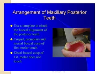 Teeth Setting Arrangement of teeth in complete denture | PPTX