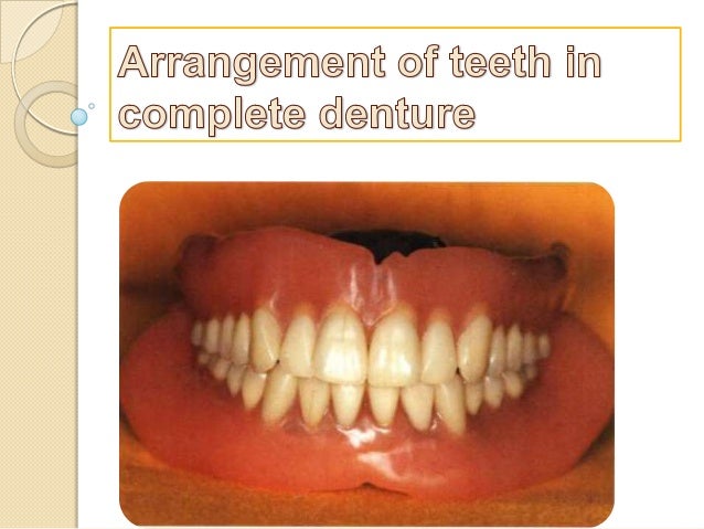 teeth setting