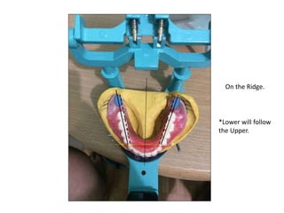 On the Ridge.
*Lower will follow
the Upper.
 