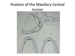 Position of the Maxillary Central
Incisor
 