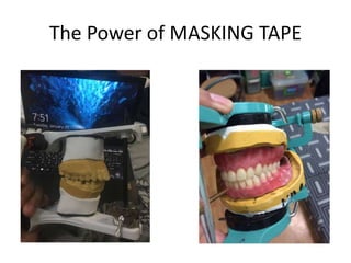 The Power of MASKING TAPE
 