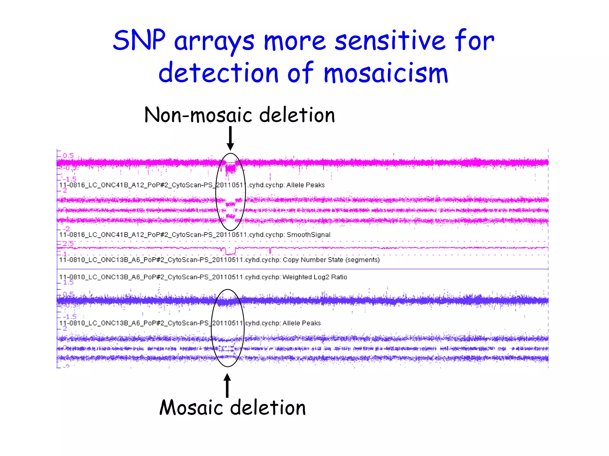 SNP arrays more sensitive for
detection of mosaicism
Non-mosaic deletion
Mosaic deletion