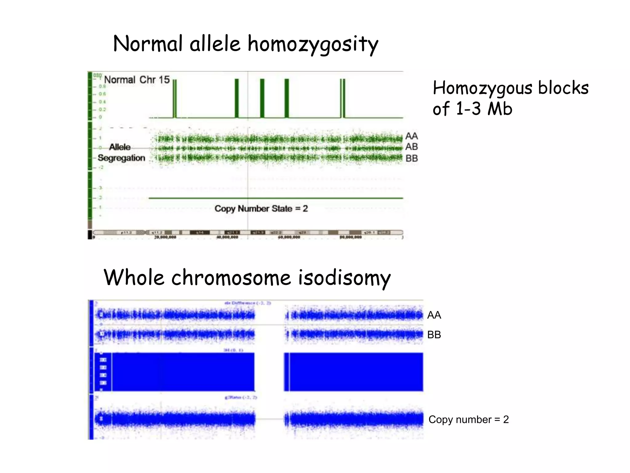 Normal allele homozygosity
Whole chromosome isodisomy
Homozygous blocks
of 1-3 Mb
AA
BB
Copy number = 2