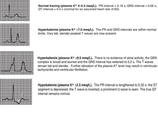 arrhthmias (1).pptx......dr kamran .......