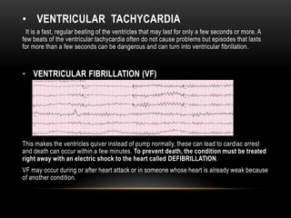 • VENTRICULAR TACHYCARDIA
It is a fast, regular beating of the ventricles that may last for only a few seconds or more. A
few beats of the ventricular tachycardia often do not cause problems but episodes that lasts
for more than a few seconds can be dangerous and can turn into ventricular fibrillation .

• VENTRICULAR FIBRILLATION (VF)

This makes the ventricles quiver instead of pump normally, these can lead to cardiac arrest
and death can occur within a few minutes. To prevent death, the condition must be treated
right away with an electric shock to the heart called DEFIBRILLATION.
VF may occur during or after heart attack or in someone whose heart is already weak because
of another condition.

 
