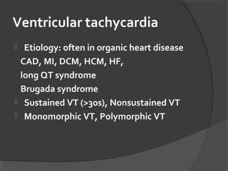 Ventricular tachycardia
 Etiology: often in organic heart disease
CAD, MI, DCM, HCM, HF,
long QT syndrome
Brugada syndrome
 Sustained VT (>30s), Nonsustained VT
 Monomorphic VT, Polymorphic VT
 