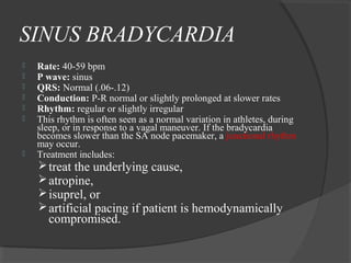 SINUS BRADYCARDIA
 Rate: 40-59 bpm
 P wave: sinus
 QRS: Normal (.06-.12)
 Conduction: P-R normal or slightly prolonged at slower rates
 Rhythm: regular or slightly irregular
 This rhythm is often seen as a normal variation in athletes, during
sleep, or in response to a vagal maneuver. If the bradycardia
becomes slower than the SA node pacemaker, a junctional rhythm
may occur.
 Treatment includes:
treat the underlying cause,
atropine,
isuprel, or
artificial pacing if patient is hemodynamically
compromised.
 