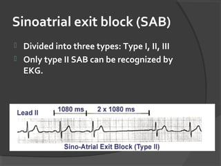Sinoatrial exit block (SAB)
 Divided into three types: Type I, II, III
 Only type II SAB can be recognized by
EKG.
 