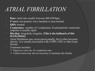 ATRIAL FIBRILLATION
 Rate: atrial rate usually between 400-650/bpm.
 P wave: not present; wavy baseline is seen instead.
 QRS: normal
 Conduction: variable AV conduction; if untreated the ventricular
response is usually rapid.
 Rhythm: irregularly irregular. (This is the hallmark of this
dysrhythmia).
 Atrial fibrillation may occur paroxysmally, but it often becomes
chronic. It is usually associated with COPD, CHF or other heart
disease.
 Treatment includes:
 Digoxin to slow the AV conduction rate.
 Cardioversion may also be necessary to terminate this rhythm.
 