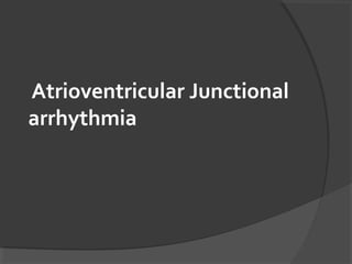 Atrioventricular Junctional
arrhythmia
 