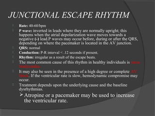 JUNCTIONAL ESCAPE RHYTHM
 Rate: 40-60/bpm
 P wave: inverted in leads where they are normally upright; this
happens when the atrial depolarization wave moves towards a
negative (-) lead.P waves may occur before, during or after the QRS,
depending on where the pacemaker is located in the AV junction.
 QRS: normal
 Conduction: P-R interval < .12 seconds if present.
 Rhythm: irregular as a result of the escape beats.
 The most common cause of this rhythm in healthy individuals is sinus
bradycardia.
 It may also be seen in the presence of a high degree or complete AV
block. If the ventricular rate is slow, hemodynamic compromise may
occur.
 Treatment depends upon the underlying cause and the baseline
dysrhythmias.
Atropine or a pacemaker may be used to increase
the ventricular rate.
 