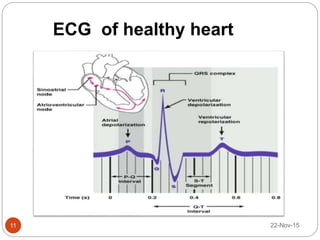 ECG of healthy heart
22-Nov-1511
 