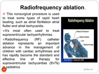 Radiofrequency ablation.
 This nonsurgical procedure is used
to treat some types of rapid heart
beating, such as atrial fibrillation atrial
flutter and atrial tachycardia.
It's most often used to treat
supraventricular tachyarrhythmias.
Radiofrequency (RF) catheter
ablation represents an important
advance in the management of
children with cardiac arrhythmias and
has rapidly become the standard and
effective line of therapy for
supraventricular tachycardias (SVTs)
in pediatrics
22-Nov-1528
 