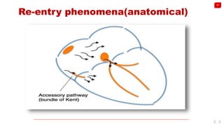 Reentry Heart Management of cardiac arrhythmias | PPTX
